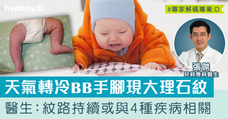 天氣轉冷BB手腳皮膚出現大理石紋？兒科醫生：紋路若不消失或與4種疾病相關