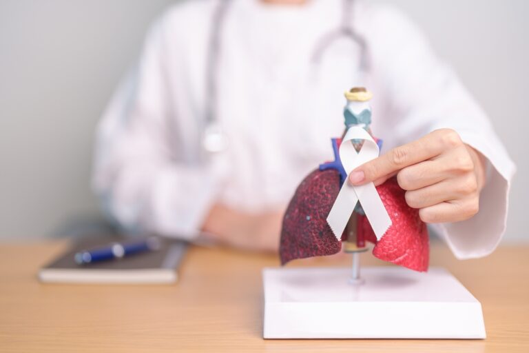 治療肺癌-肺癌篩查