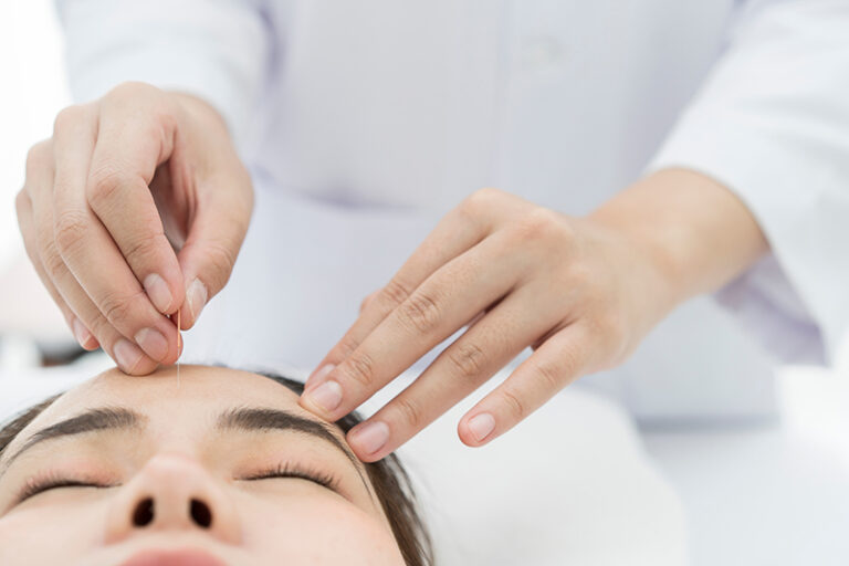 面癱-周圍性面癱-中風-分別-症狀-治療-中醫-針灸-方樹堅醫師