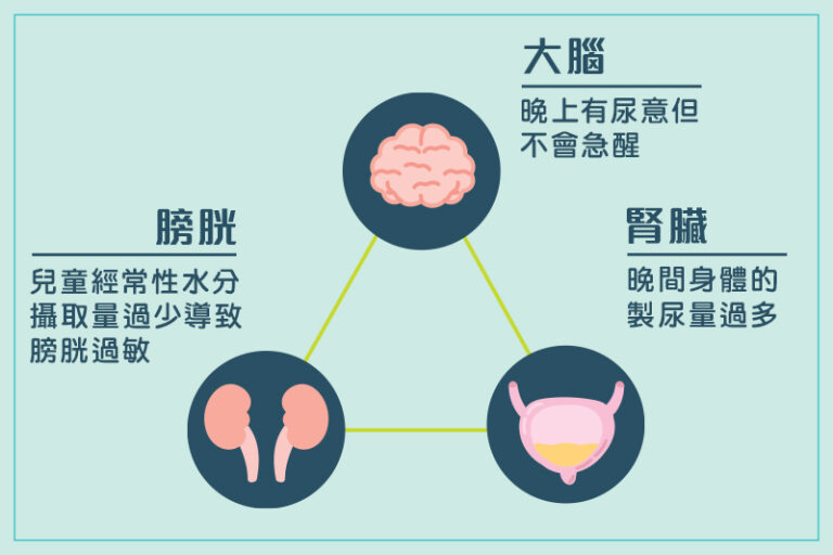 小童尿床-兒童瀨尿-夜遺尿-失禁