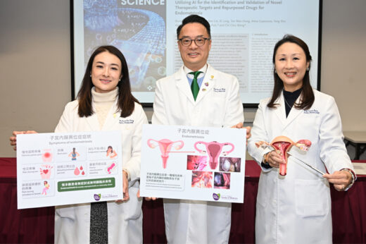 朱古力瘤｜中大研究揭治療子宮內膜異位症新靶點｜乾眼症藥物「舊藥新用」 助抑制異位內膜組織生長
