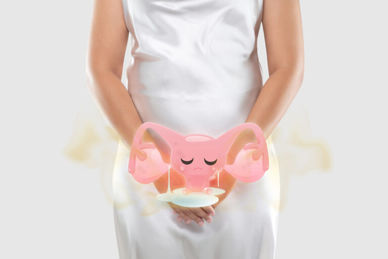 朱古力瘤｜中大研究揭治療子宮內膜異位症新靶點｜乾眼症藥物「舊藥新用」 助抑制異位內膜組織生長