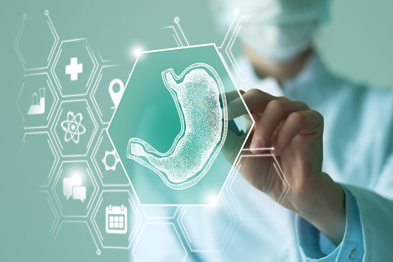 胃癌成因-症狀-高危群組-治療-預防