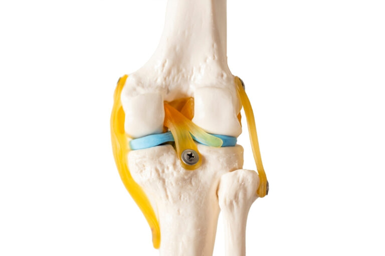 改善關節退化?應選擇葡萄糖胺還是膠原蛋白?