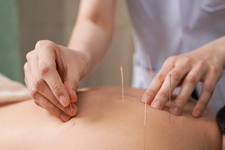 針灸-中風症狀-爆血管-風險-春天養肝-黃劍峯中醫師