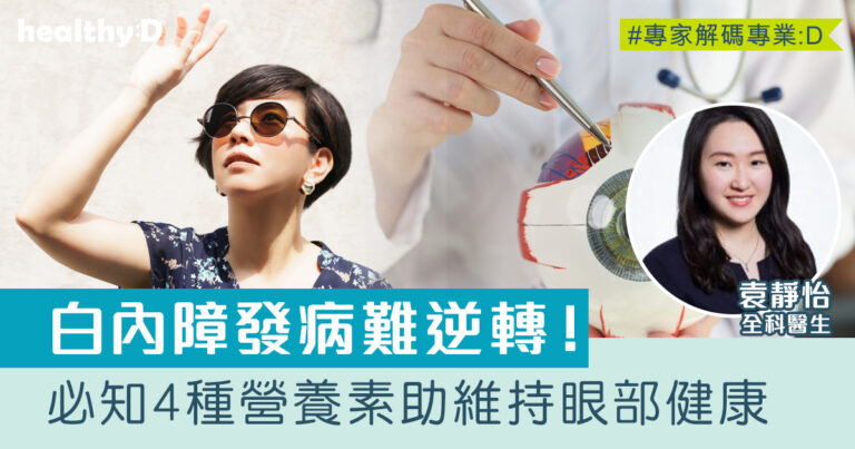 防曬護眼｜白內障、黃斑病變發病難逆轉　醫生推介4種營養素助維持眼部健康