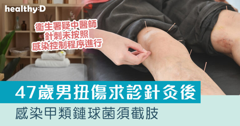 食肉菌｜47歲男針灸後感染甲類鏈球菌須截肢 衞生署疑中醫師針刺未按照感染控制程序進行