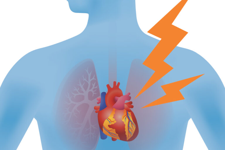 新冠後遺症-新冠病毒損體內皮細胞-血管疾病-心臟科醫生-陳麒尹