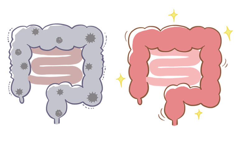 大便形狀-狀態-質感-反映甚麼-黃劍峯中醫
