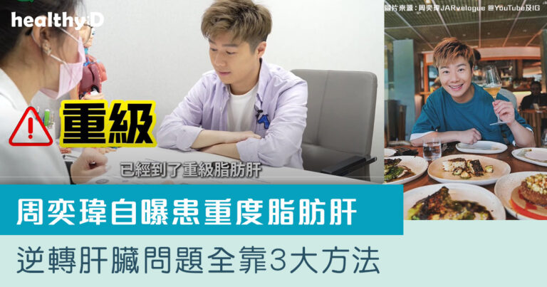 周奕瑋自曝患重度脂肪肝　逆轉肝臟問題全靠3大方法
