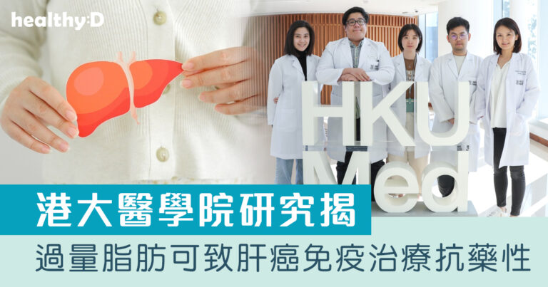 肝癌｜港大醫學院揭過量脂肪可致肝癌免疫治療抗藥性 倡健康飲食減少危害肝臟