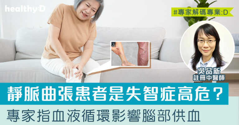 靜脈曲張增認知障礙症風險64%！中醫解構靜脈曲張與失智症關係、治療及預防方法