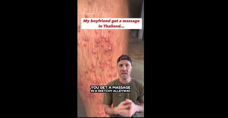 泰式腳底按摩-泰式按摩-金黃葡萄球菌-衞生隱患