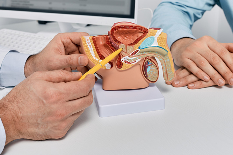 泰山患癌-前列腺癌-前列腺癌治療