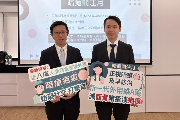 暗瘡關注月|調查:近8成人受暗瘡影響外觀 醫生籲正確治療及處理 減心理壓力