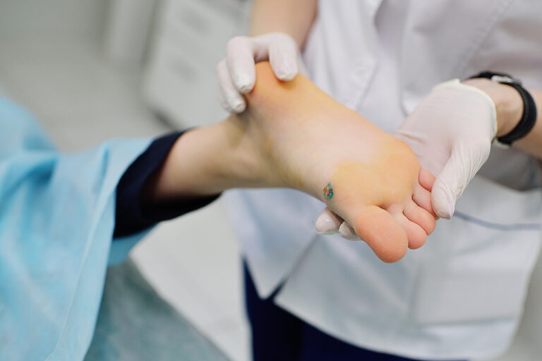 黑色素瘤皮膚癌-手掌腳底黑痣-指甲黑線-黑色素瘤成因-症狀-治療-預防-皮膚科胡惠福醫生