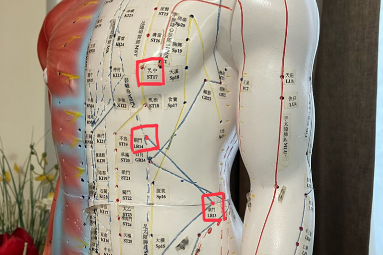 中醫治療甲狀腺結節-乳腺增生-子宮肌瘤-穴位按摩-食療-浸大中醫