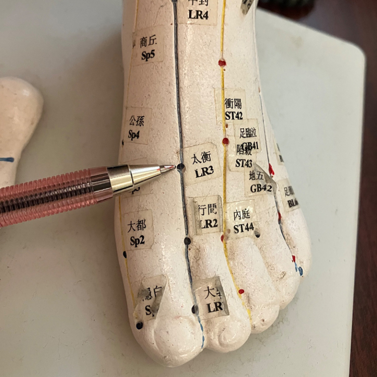 中醫治療甲狀腺結節-乳腺增生-子宮肌瘤-穴位按摩-食療-浸大中醫