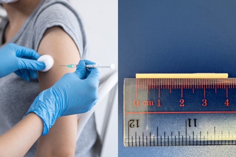 避孕方法推薦｜擔心「意外」發生？醫生拆解1款避孕方法達99.9% 　 3年長效避孕　餵哺母乳婦女都適