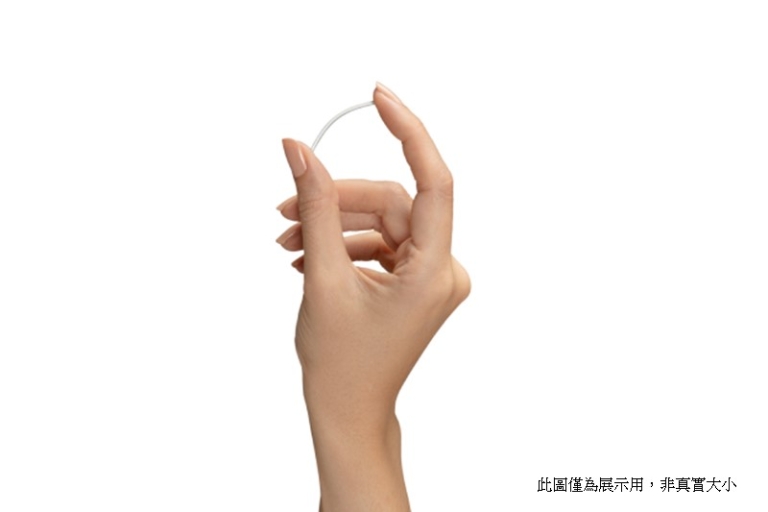 避孕方法推薦｜擔心「意外」發生？醫生拆解1款避孕方法達99.9% 　 3年長效避孕　餵哺母乳婦女都適