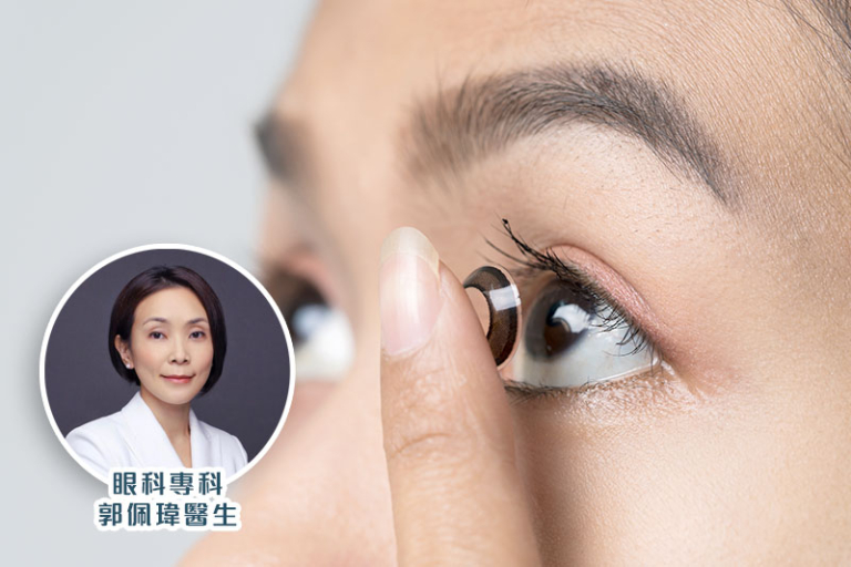 隱形眼鏡-迷思-眼科專科郭佩瑋醫生