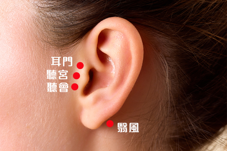 耳鳴中醫治療-耳鳴原因-食療-穴位-仁濟醫院