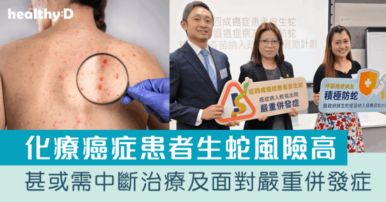 帶狀疱疹生蛇病毒｜化療癌症患者生蛇風險可高達25倍　甚或需中斷治療及面對嚴重併發症