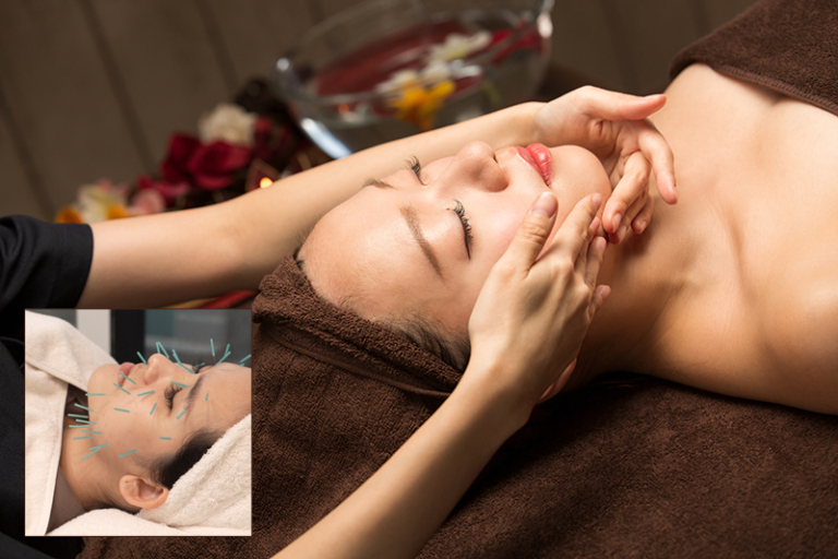 中醫診所推薦 | 中醫走進美容界！美顏針/暗瘡/抗衰老/皮膚護理/修面提拉 由內而外調理養生