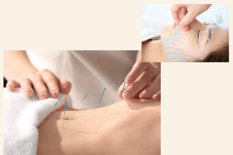 中醫診所推薦 | 中醫走進美容界！美顏針/暗瘡/抗衰老/皮膚護理/修面提拉 由內而外調理養生