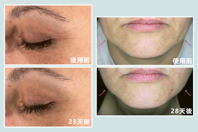 逆齡抗老產品推薦-瑞士生物科研-珍稀植物萃取出活性成分-淡紋緊緻-時光瑞蘋凍Swiss-StemGlow-Jelly-Smartol腦活益