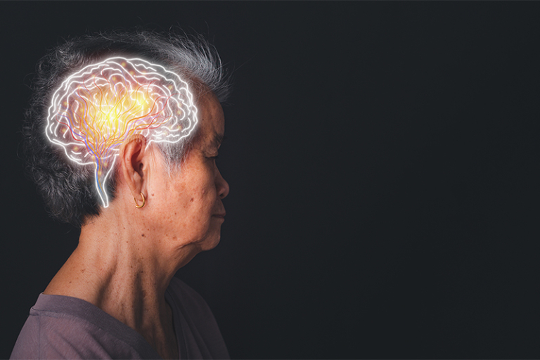 認知障礙症防治-診斷-陳鎮中醫生