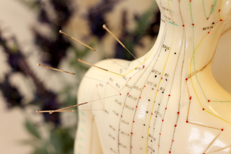 情緒健康｜中醫談創傷後壓力症 治療靠服藥、針灸等 配合飲食、起居等調養