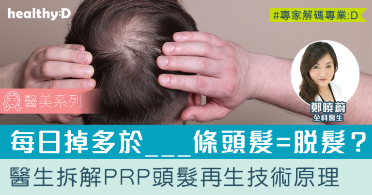 脫髮解決方法  | PRP 能解決脫髮困擾嗎？一文看清掉髮原因及治療