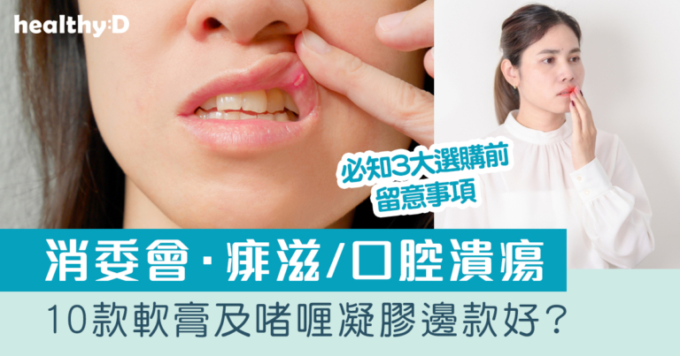 消委會．痱滋/口腔潰瘍｜10款軟膏及啫喱凝膠邊款好？哪款屬處方藥物？有哪些受關注成分？｜必知3大選購留意事項