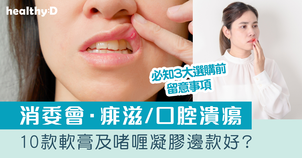 消委會.痱滋/口腔潰瘍|10款軟膏及啫喱凝膠邊款好?哪款屬處方藥物?有哪些受關注成分?|必知3大選購留意事項 | healthyD.com