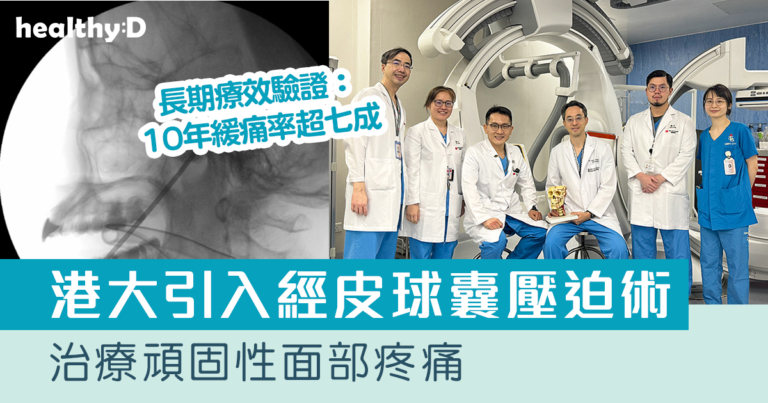 慢性口面部疼痛｜港大醫學院率先引入經皮球囊壓迫術治療頑固性面部疼痛 長期療效驗證：十年緩痛率超七成