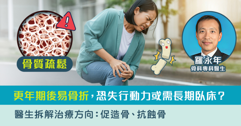 骨質疏鬆｜更年期後易骨折，恐失行動力或需長期臥床？醫生拆解治療方向：促造骨、抗蝕骨