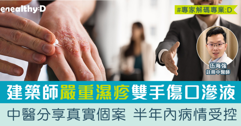 濕疹可以斷尾嗎？中醫分享真實個案 半年內病情受控