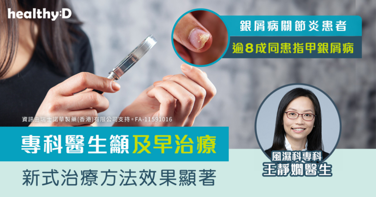 銀屑病關節炎｜逾8成銀屑病關節炎患者同患指甲銀屑病  革命性治療扭轉銀屑病發病軌跡