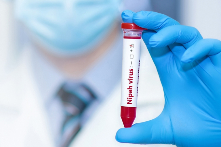 尼帕病毒｜印度疑爆發人傳人感染｜死亡率高達75％！有冇藥醫？尼帕病毒症狀及預防方法一文睇