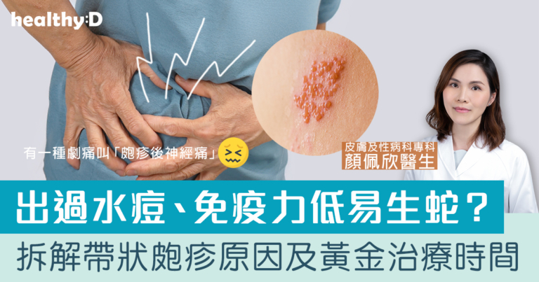 生蛇不是老人病！出過水痘易生蛇？醫生拆解帶狀皰疹原因、症狀及黃金治療時間