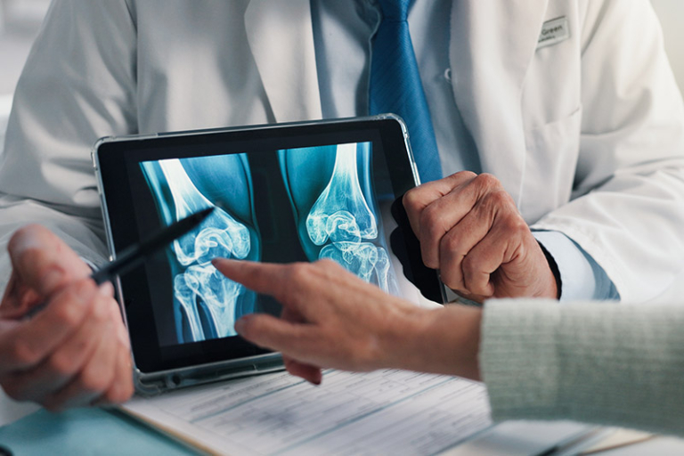 2026專業關節4大保養貼士：家用止痛儀器推薦