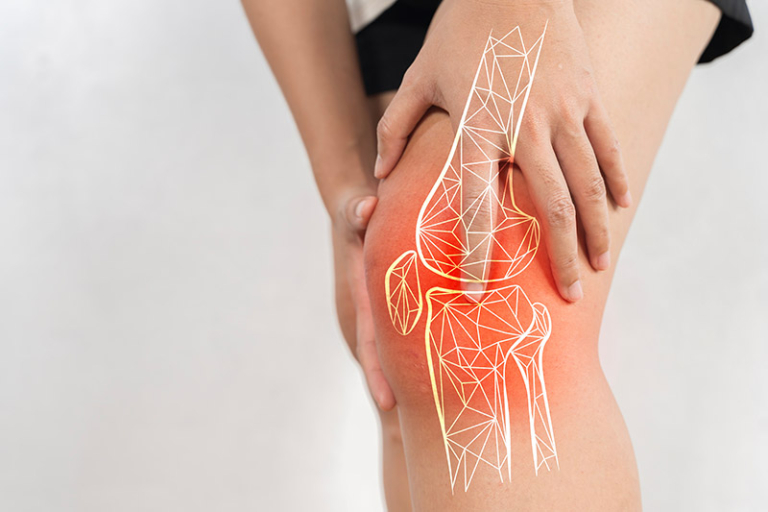 關節痛、上落樓梯膝蓋痛點算好｜9成港人有關節不適　關節健康已年輕化