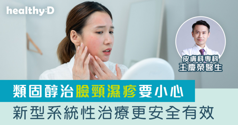 類固醇治臉頸濕疹要小心  	新型進階治療更安全有效