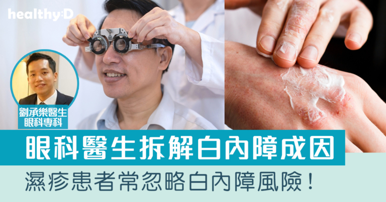 濕疹與白內障成因關係拆解 眼科醫生：嶄新手術可同時改善近視