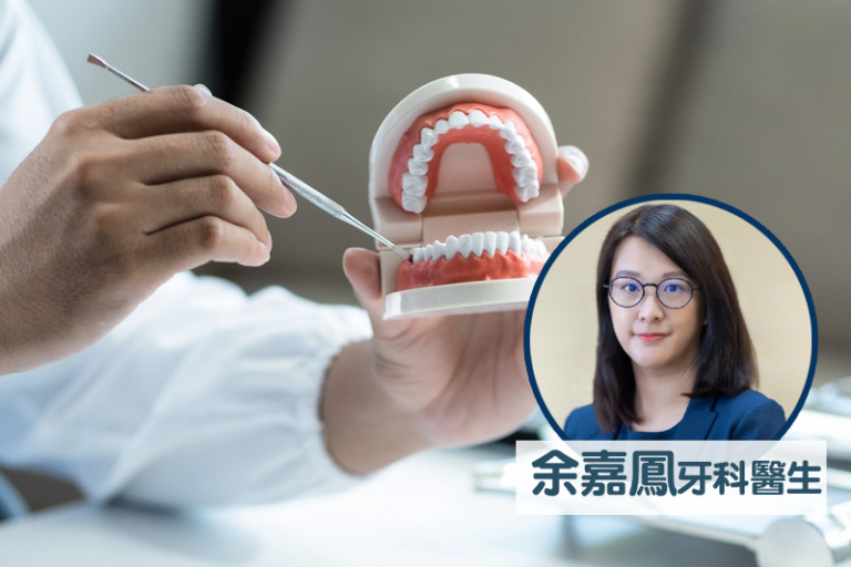 小朋友換牙順序？牙科醫生拆解兒童換牙期注意事項：給家長的專業建議