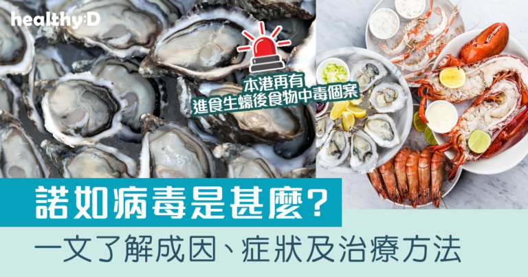 諾如病毒｜本港再有進食生蠔後食物中毒個案｜附成因、傳播途徑、症狀及治療方法