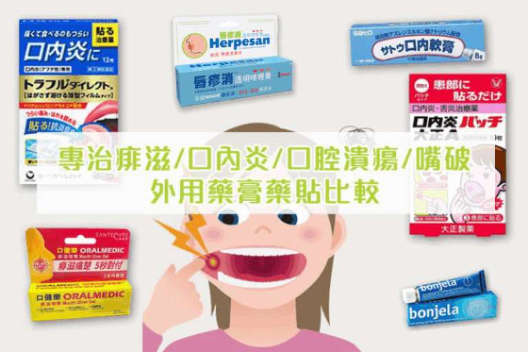 痱滋藥推薦-口內炎-口腔潰瘍-嘴破-成因-治療-預防