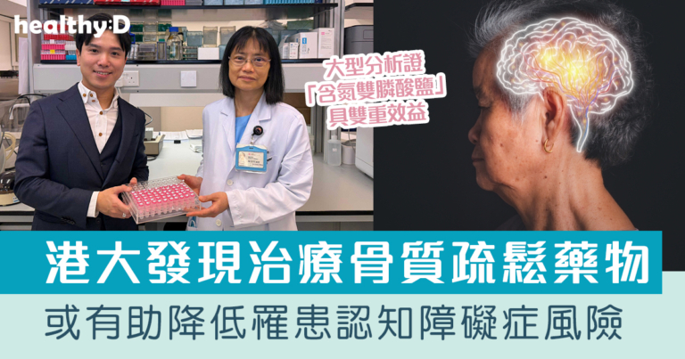 認知障礙症治療｜港大醫學院發現治療骨質疏鬆藥物或有助降低罹患認知障礙症風險