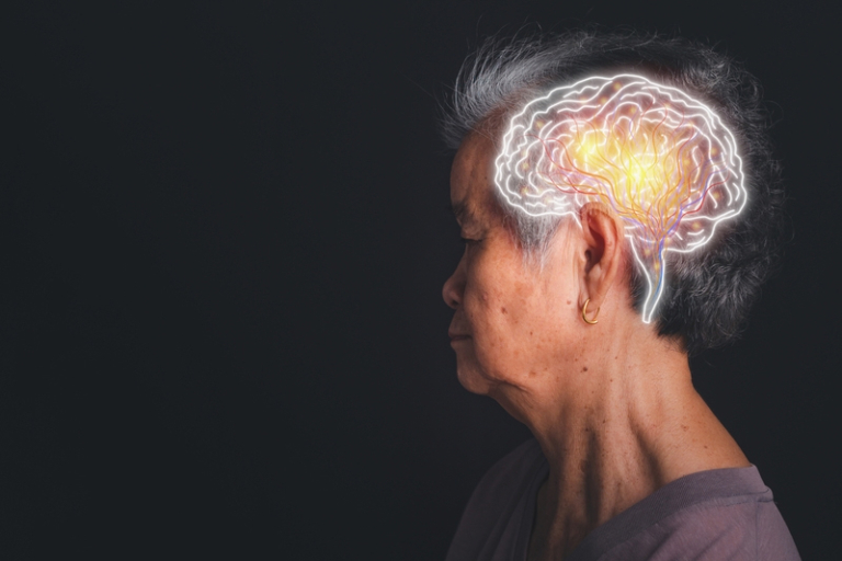 港大醫學院藥理及藥劑學系的研究團隊發現，廣泛應用於治療骨質疏鬆症的藥物「含氮雙膦酸鹽」，或有助骨質疏鬆症或脆性骨折的老年患者降低罹患阿茲海默症及相關認知障礙症（ADRD）的風險。此舊藥新用方法有望成為預防退化性腦部疾病的可行方向，從而減輕此症對全球公共衞生帶來的負擔。